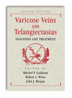 Varicose Veins and Telangiectasias: Diagnosis and Treatment, Second Edition