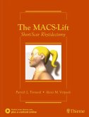 The Macs-Lift