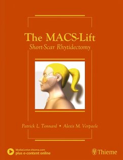 The Macs-Lift - Tonnard, Patrick;Verpaele, Alexis