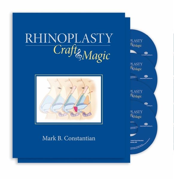 Rhinoplasty