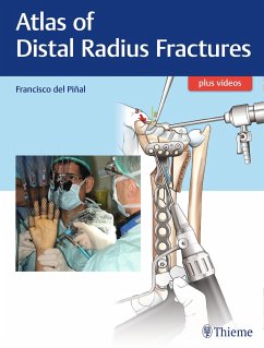 Atlas of Distal Radius Fractures - Piñal, Francisco del
