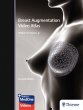 Breast Augmentation Video Atlas - Bild 1