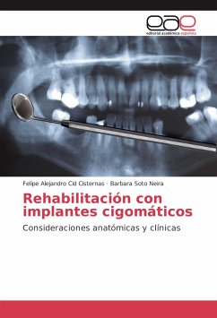 Rehabilitación con implantes cigomáticos - Cid Cisternas, Felipe Alejandro;Soto Neira, Barbara