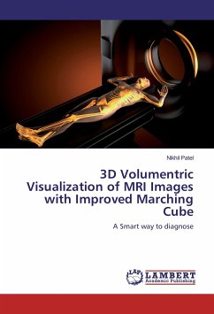 3D Volumentric Visualization of MRI Images with Improved Marching Cube - Patel, Nikhil