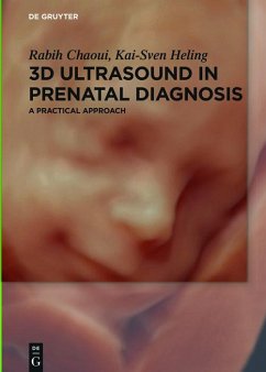 3D Ultrasound in Prenatal Diagnosis (eBook, PDF) - Chaoui, Rabih; Heling, Kai-Sven