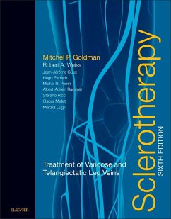 Sclerotherapy E-Book (eBook, ePUB) - Goldman, Mitchel P.; Weiss, Robert A