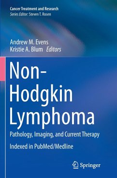 Non-Hodgkin Lymphoma