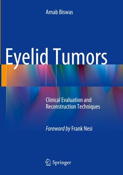 Eyelid Tumors - Biswas, Arnab