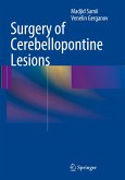 Surgery of Cerebellopontine Lesions
