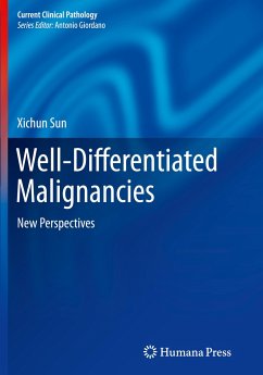 Well-Differentiated Malignancies - Sun, Xichun