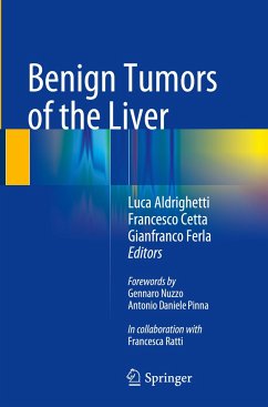 Benign Tumors of the Liver