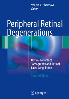 Peripheral Retinal Degenerations