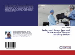 Prelacrimal Recess Approach for Removal of Anterior Maxillary Lesions - Al Murtadha, Abdullah