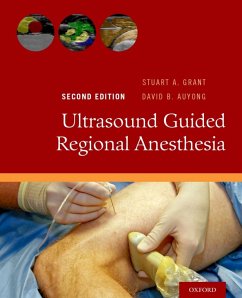 Cover Ultrasound Guided Regional Anesthesia (eBook, ePUB)