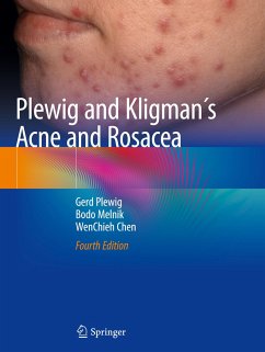 Plewig and Kligman´s Acne and Rosacea - Plewig, Gerd;Melnik, Bodo;Chen, WenChieh