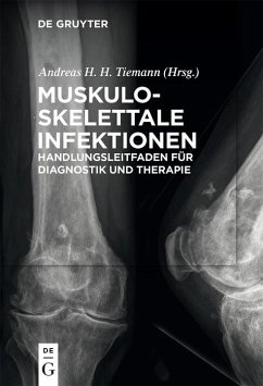 Muskuloskelettale Infektionen (eBook, ePUB)