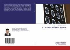 CT rule in ischemic stroke - Alahmari, Abdulwahab