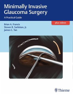 Minimally Invasive Glaucoma Surgery - Francis, Brian;Sarkisian, Steven;Tan, James C.