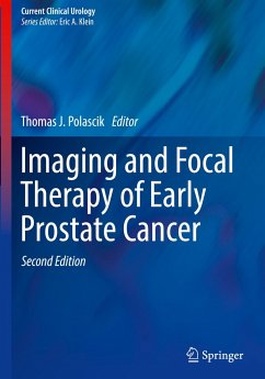 Imaging and Focal Therapy of Early Prostate Cancer