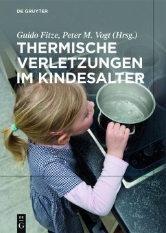 Thermische Verletzungen im Kindesalter (eBook, ePUB)