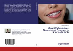 Class II Malocclusion : Diagnosis and Treatment in Growing Patients