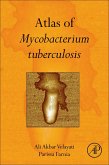 Atlas of Mycobacterium Tuberculosis (eBook, ePUB) Atlas of Mycobacterium Tuberculosis (eBook, ePUB)