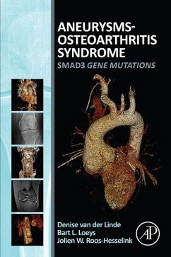 Aneurysms-Osteoarthritis Syndrome (eBook, ePUB) - Linde, Denise van der; Roos-Hesselink, Jolien; Loeys, Bart L.