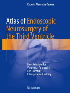 Atlas of Endoscopic Neurosurgery of the Third Ventricle - Dezena, Roberto Alexandre