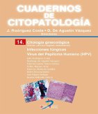 Citología ginecológica : infecciones fúngicas : virus del papiloma humano (HPV)