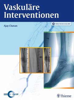 Vaskuläre Interventionen (eBook, ePUB)