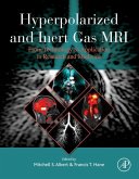 Hyperpolarized and Inert Gas MRI (eBook, ePUB)