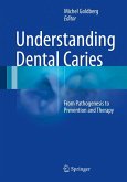Understanding Dental Caries (eBook, PDF)