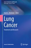 Lung Cancer (eBook, PDF)
