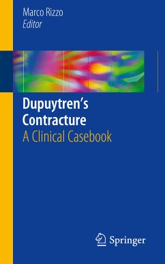 Dupuytren’s Contracture (eBook, PDF)