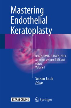 Mastering Endothelial Keratoplasty (eBook, PDF)