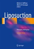 Liposuction (eBook, PDF)