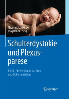 Schulterdystokie und Plexusparese (eBook, PDF)