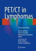 PET/CT in Lymphomas (eBook, PDF)