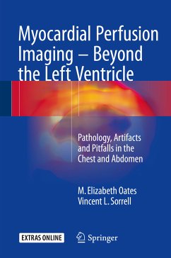 Myocardial Perfusion Imaging - Beyond the Left Ventricle (eBook, PDF) - Oates, M. Elizabeth; Sorrell, Vincent L.