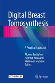 Digital Breast Tomosynthesis (eBook, PDF)