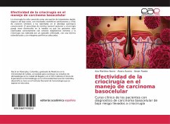 Efectividad de la criocirugía en el manejo de carcinoma basocelular - Martínez Ibarra, Ana;Acosta, Alvaro;Rueda, Xavier