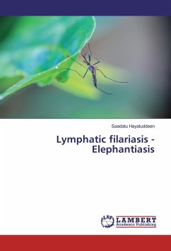 Lymphatic filariasis - Elephantiasis