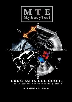 Ecografia del Cuore - MyEasyTest - Felitti, Giuseppe; Bovani, Stefano