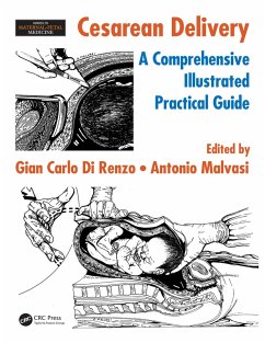 Cover Cesarean Delivery (eBook, ePUB)