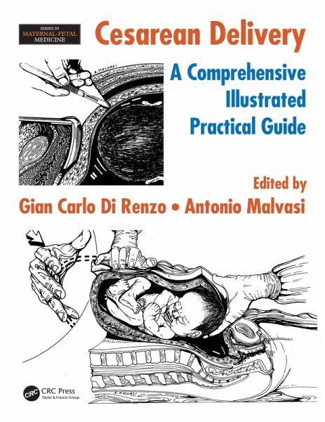 Cesarean Delivery (eBook, ePUB) Cesarean Delivery (eBook, ePUB)