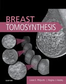 Breast Tomosynthesis E-Book (eBook, ePUB)