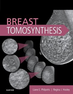 Breast Tomosynthesis E-Book (eBook, ePUB) - Philpotts, Liane E; Hooley, Regina J