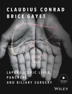 Laparoscopic Liver, Pancreas, and Biliary Surgery (eBook, ePUB)