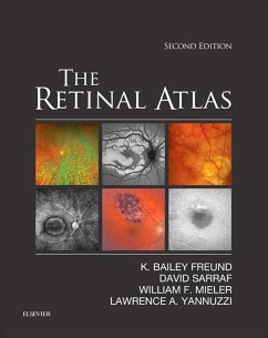 The Retinal Atlas E-Book (eBook, ePUB) - Freund, K. Bailey; Sarraf, David; Mieler, William F.; Yannuzzi, Lawrence A.