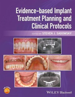 Evidence-based Implant Treatment Planning and Clinical Protocols (eBook, PDF)